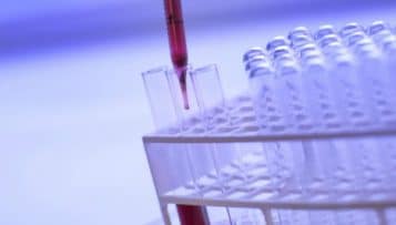 Améliorer le dispositif de prévention et de lutte contre le VIH/Sida