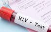 La politique de dépistage du VIH sévèrement critiquée