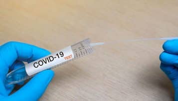 Covid-19 : le CNRS et l’Inserm mobilisés pour réaliser des tests de dépistage