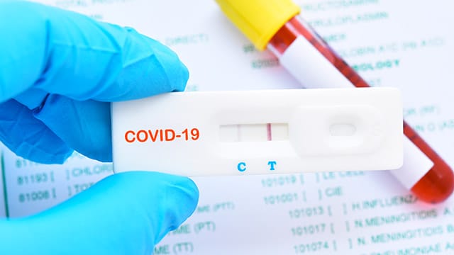 Covid-19 : le ministère de la Santé élargit l'autorisation des tests antigéniques
