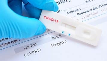 Covid-19 : après la bataille des masques, les collectivités lancent celle des tests