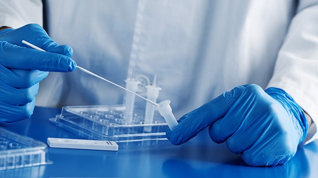 Bientôt la fin des tests de "confort" en France : un pari à "double tranchant"